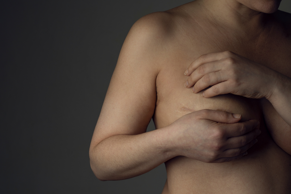 Woman covering her breasts, representing breast cancer.